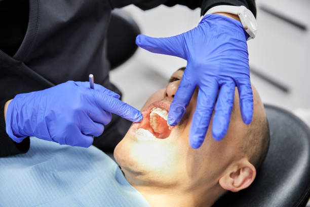 Best Emergency Care for Gum Disease in Rocky Point, WA